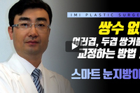 쌍수 없이 여러 겹, 두 겹 쌍꺼풀 교정하는 방법!! '스마트 눈지방이식' 