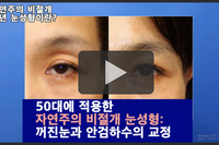 수술 한 티 안나는 자연주의 비절개 눈성형 -라인강화법-