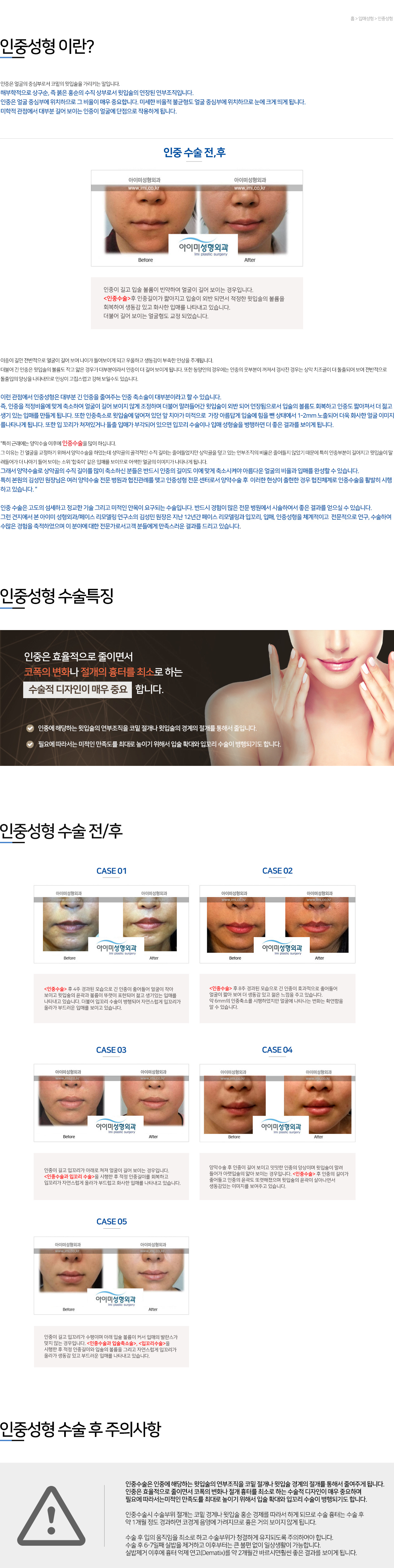 이미지명