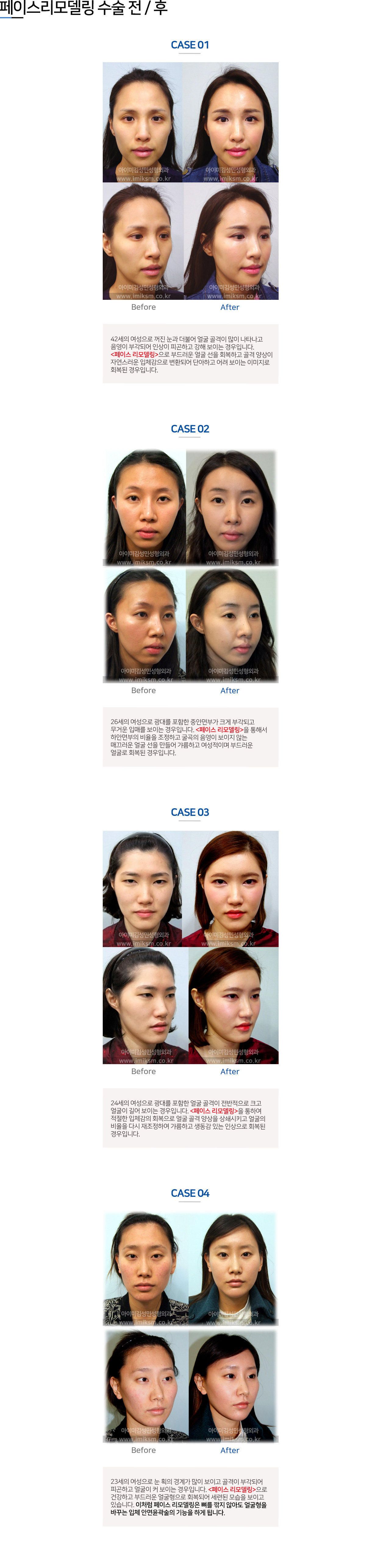 이미지명