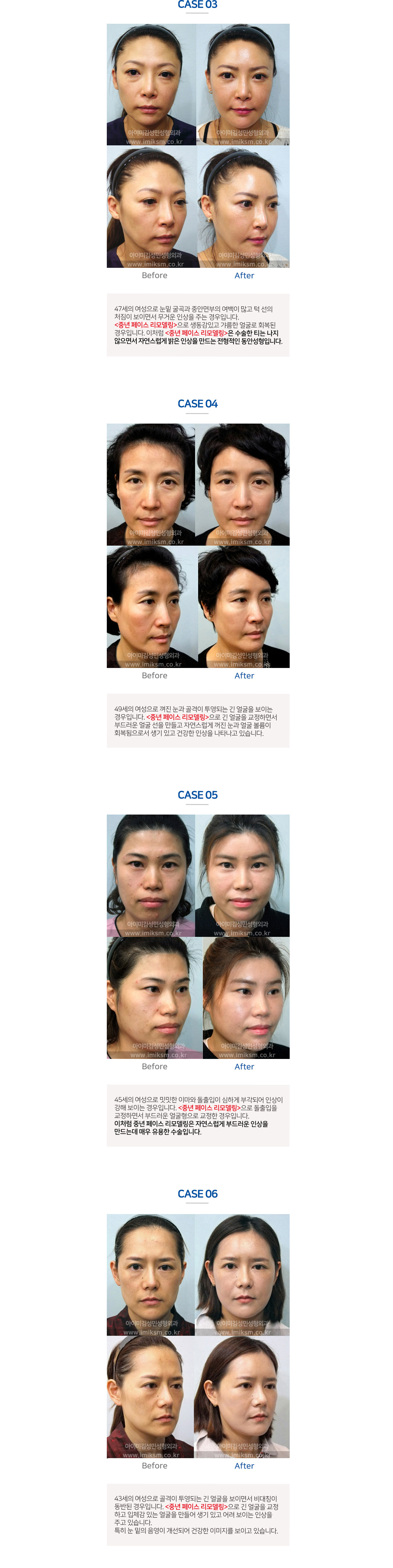 이미지명