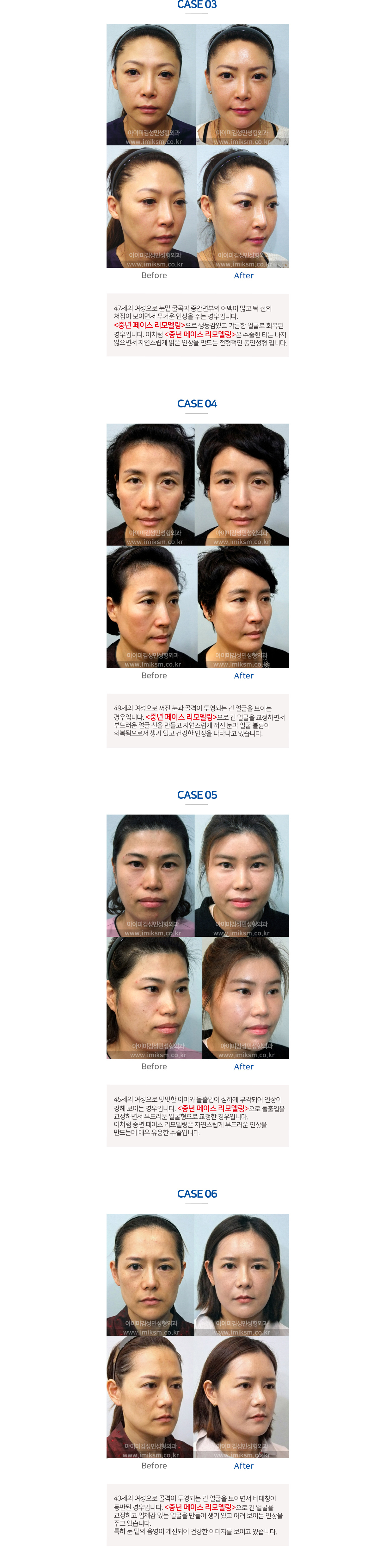 이미지명