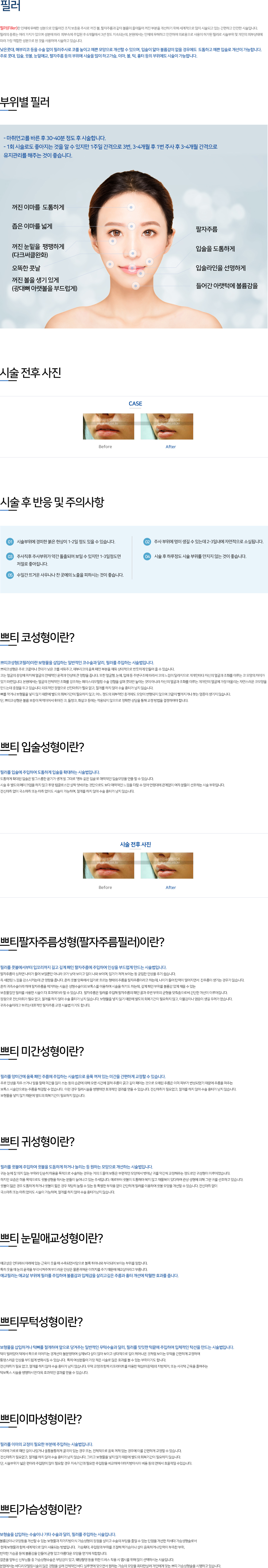 이미지명