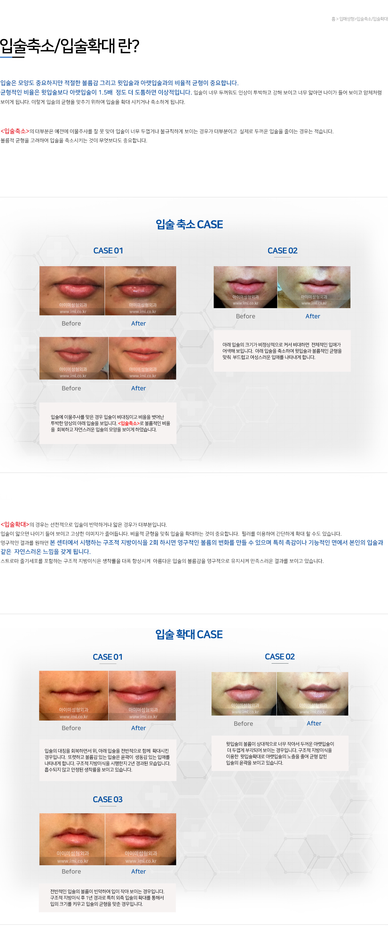 이미지명