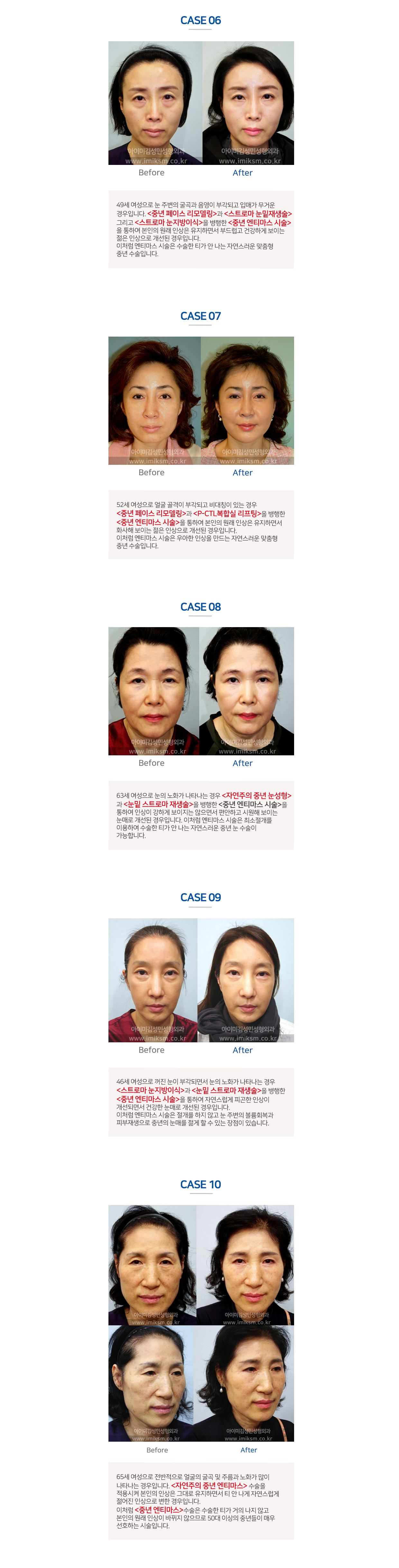 이미지명