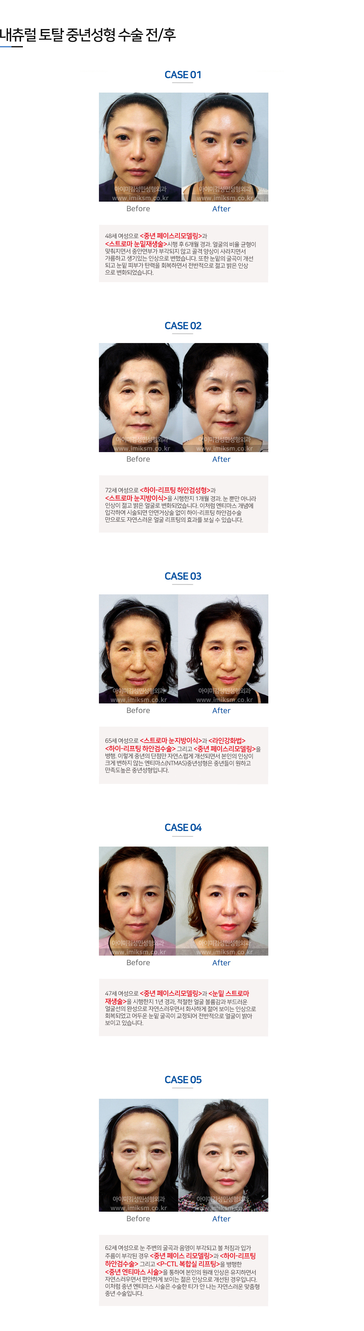 이미지명