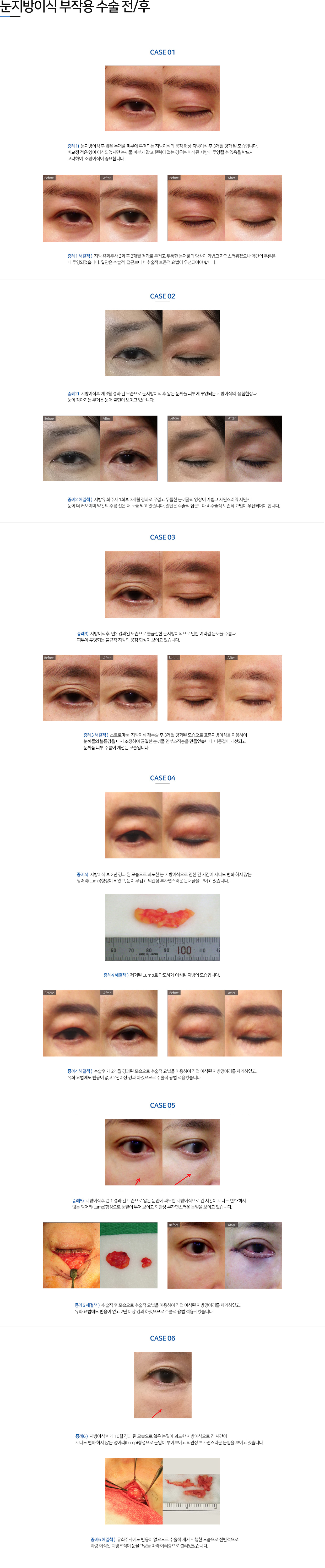 이미지명