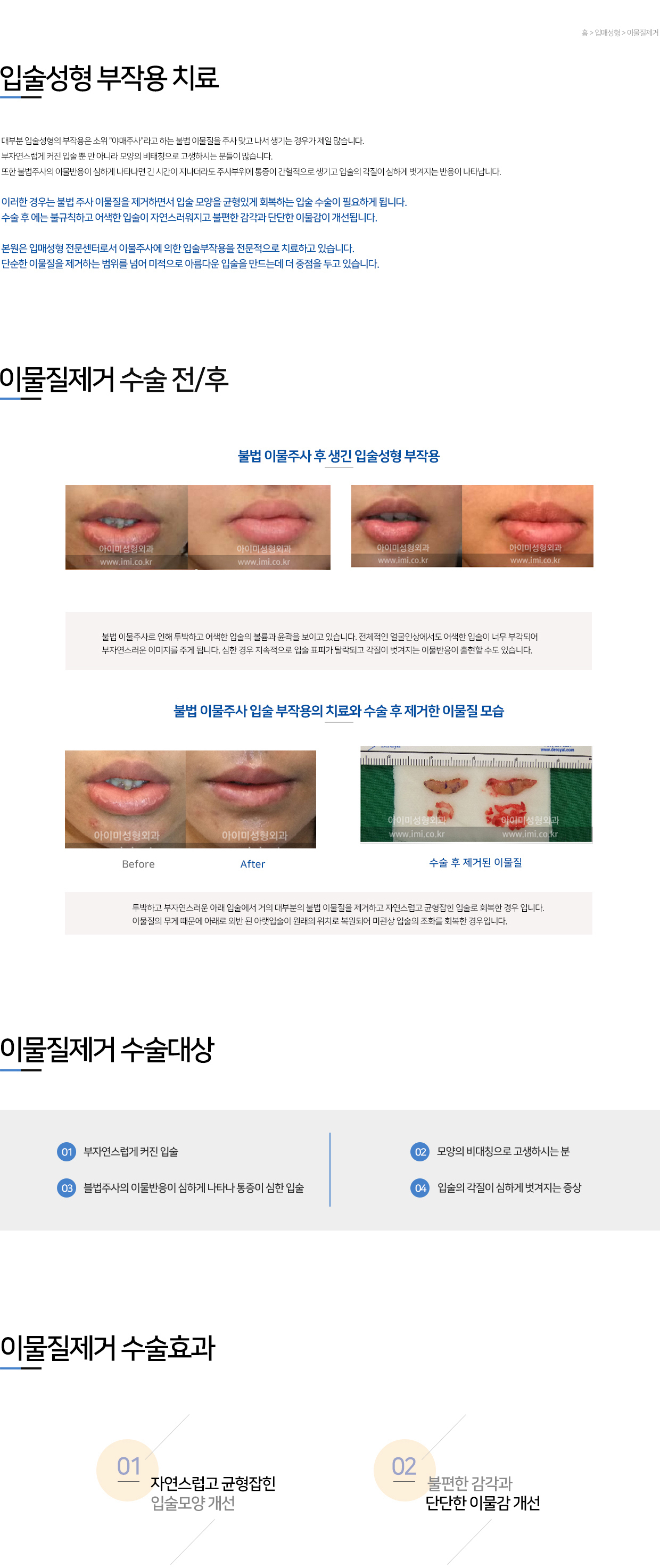 이미지명