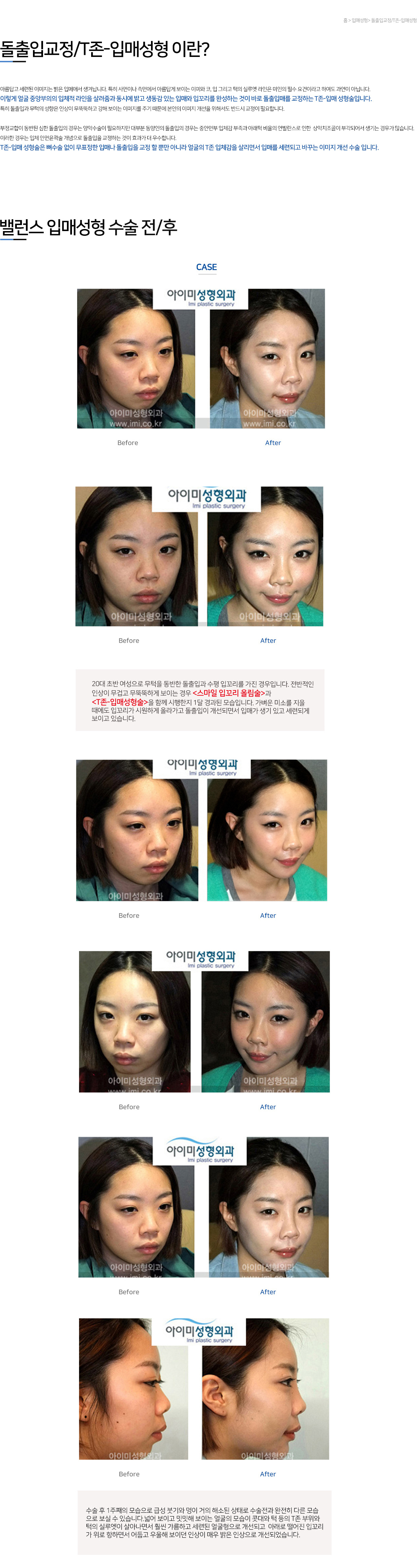 이미지명