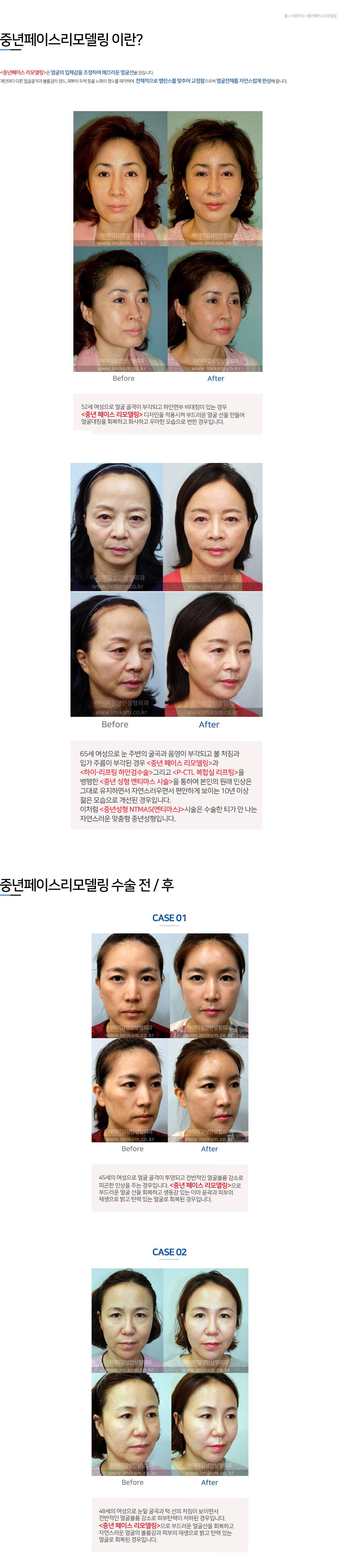 이미지명